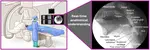 PhD opportunity [June 2026 start] on "Anatomy localisation in X-ray fluoroscopy videos for mechanical thrombectomy" in collaboration with Telos Health